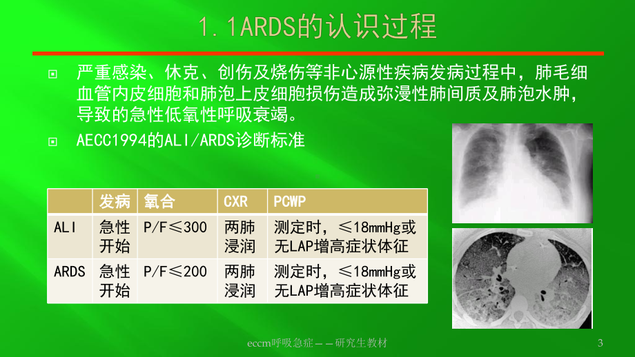 eccm呼吸急症-研究生教材课件.pptx_第3页