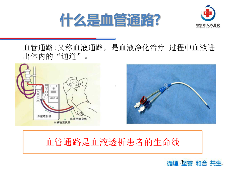 CRRT血管通路的护理方案参考课件.ppt_第3页