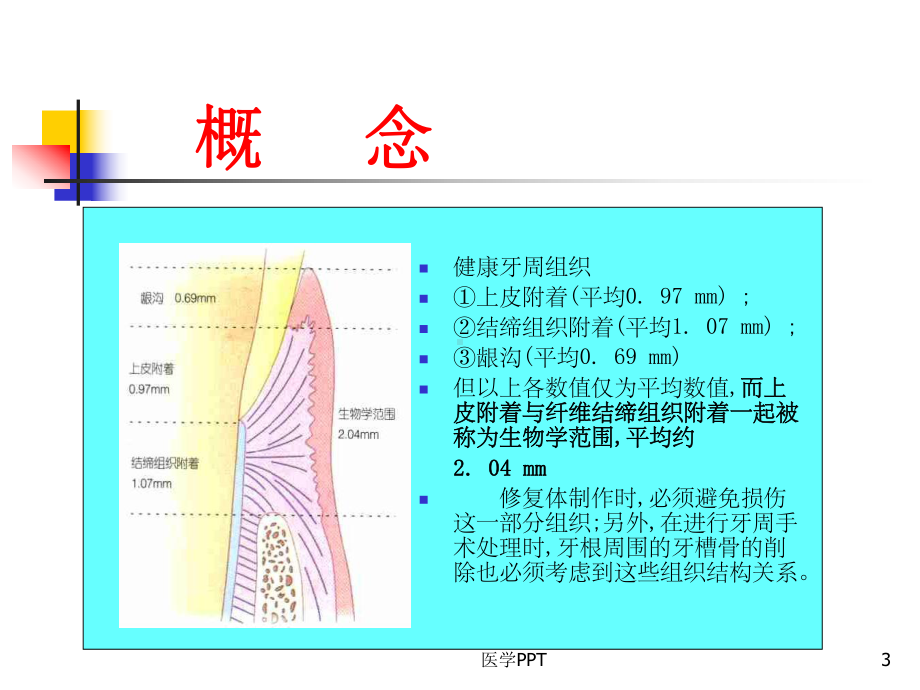 《口腔修复学》课件.ppt_第3页