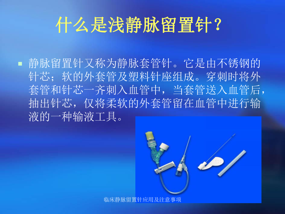 临床静脉留置针应用及注意事项课件.ppt_第3页