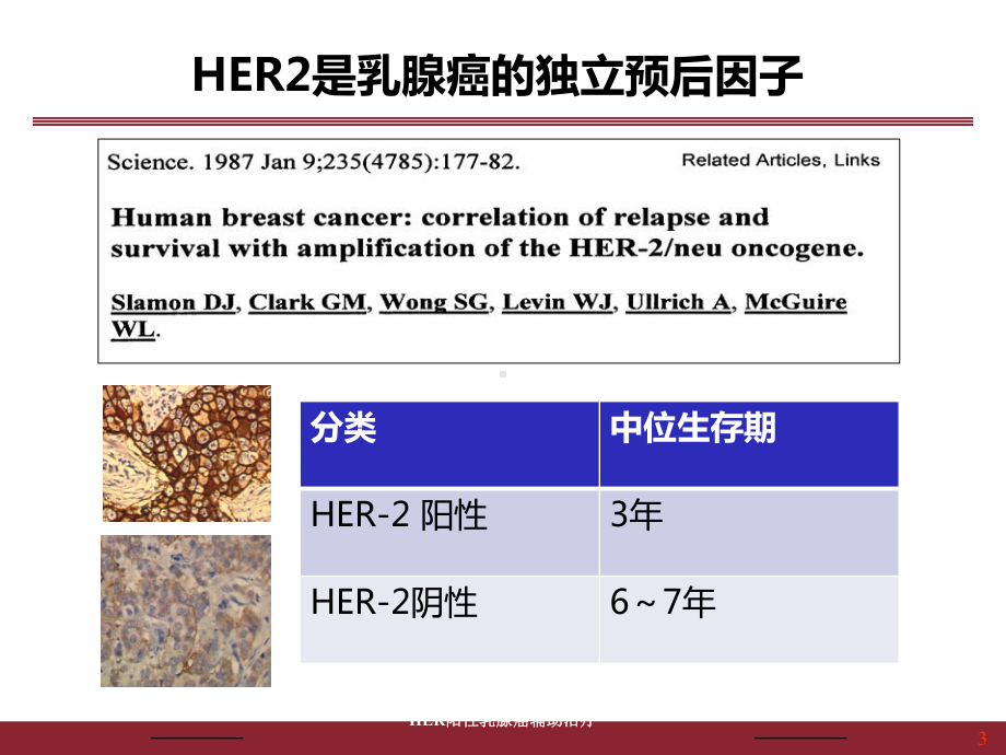 HER阳性乳腺癌辅助治疗培训课件.ppt_第3页