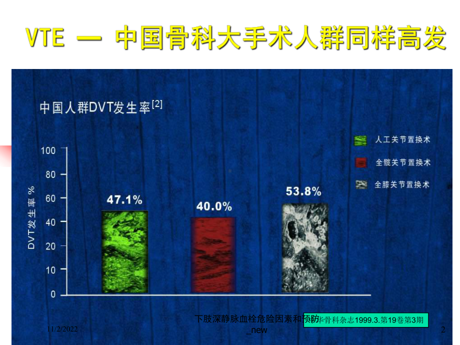 下肢深静脉血栓危险因素和预防-new课件.ppt_第2页