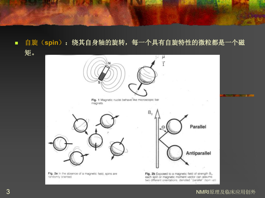 NMRI原理及临床应用创外课件.ppt_第3页