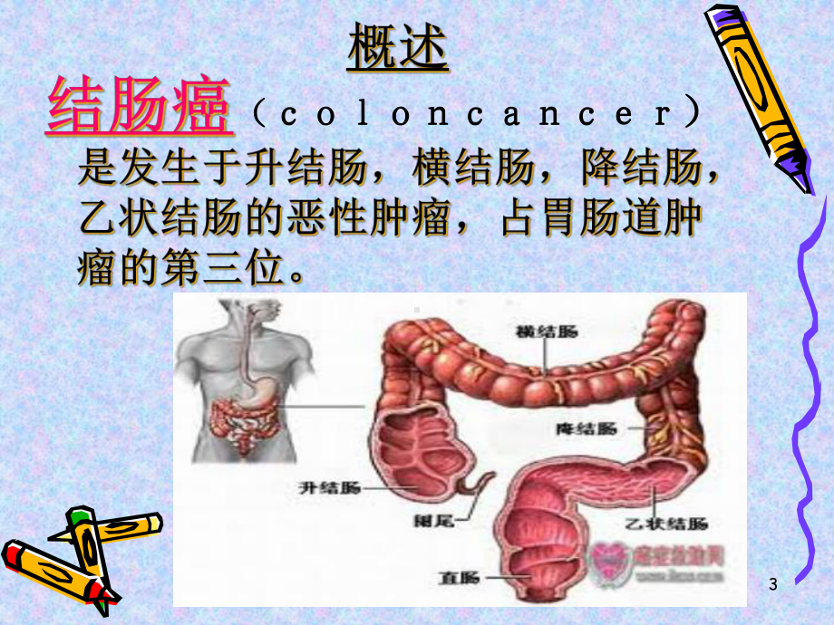 1例右半结肠切除术患者护理查房课件.ppt_第3页