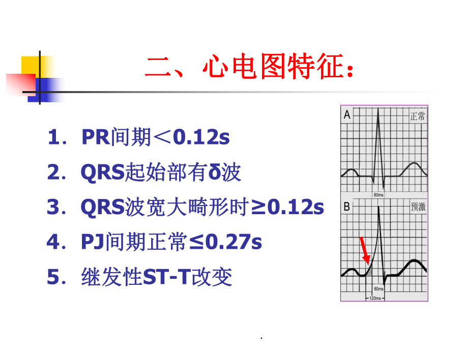 《预激综合征教程》课件.ppt_第3页