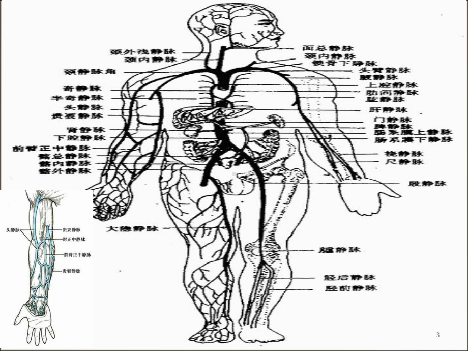 PICC置管护理医学课件.pptx_第3页