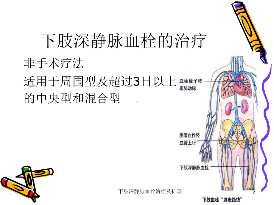 下肢深静脉血栓治疗及护理课件.ppt_第2页