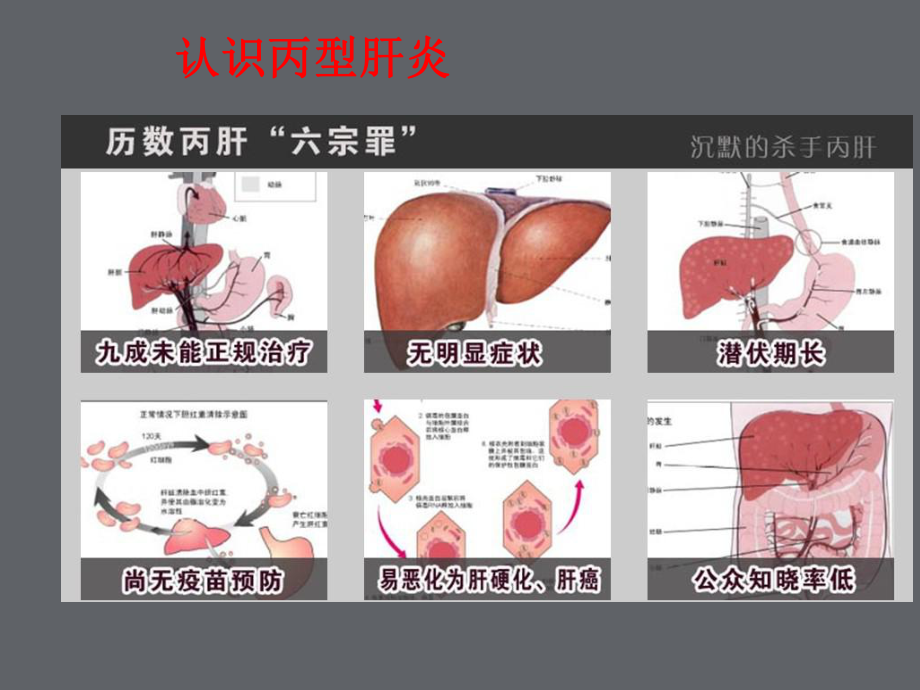 丙型肝炎防治知识课件.ppt_第2页