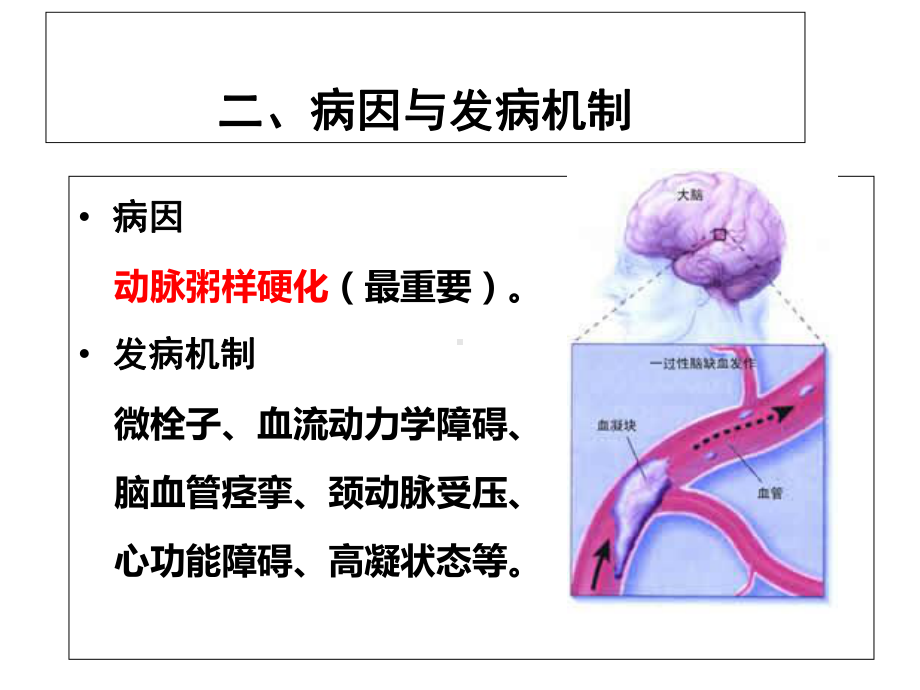 短暂性脑缺血发作课件-.ppt_第3页