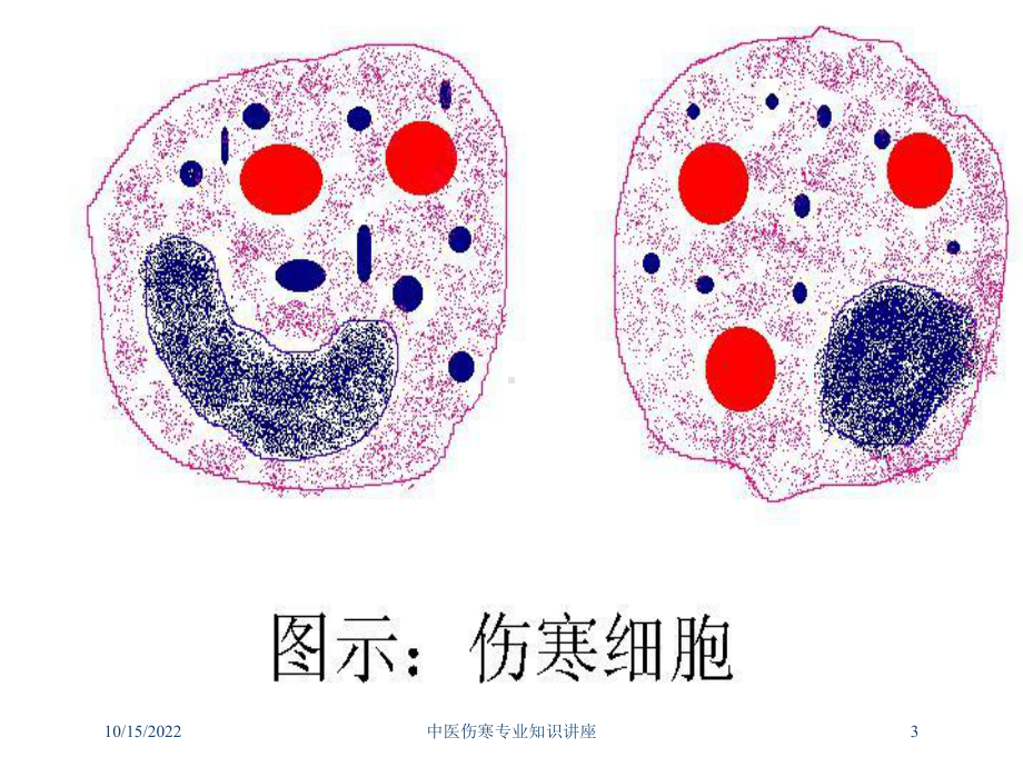 中医伤寒专业知识讲座培训课件.ppt_第3页