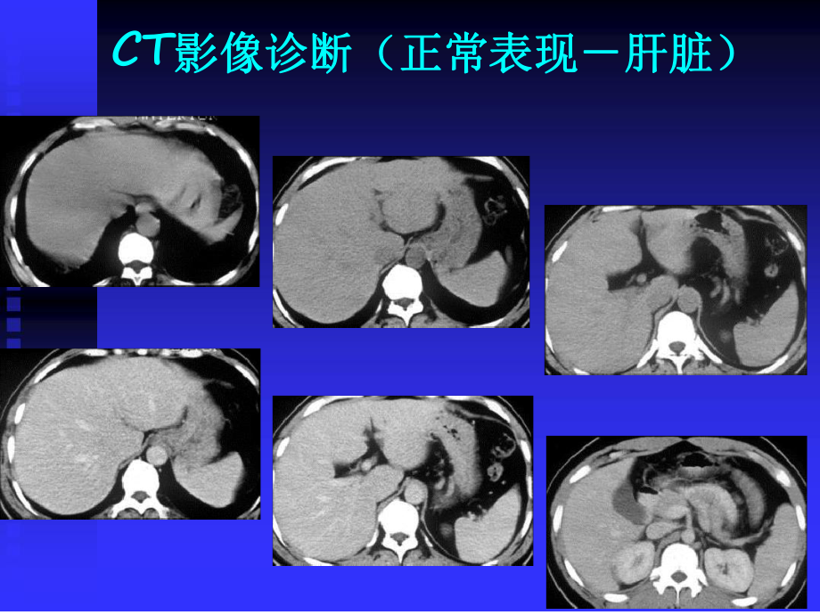 临床执业医师考试大纲医学影像学CT课件.ppt_第2页