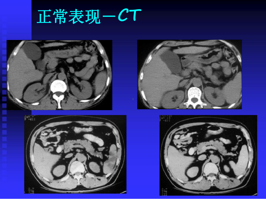 临床执业医师考试大纲医学影像学CT课件.ppt_第3页