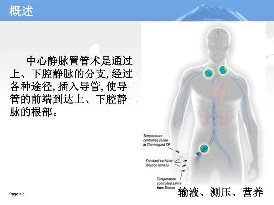 中心静脉置管术的护理(医疗知识)课件.ppt_第2页