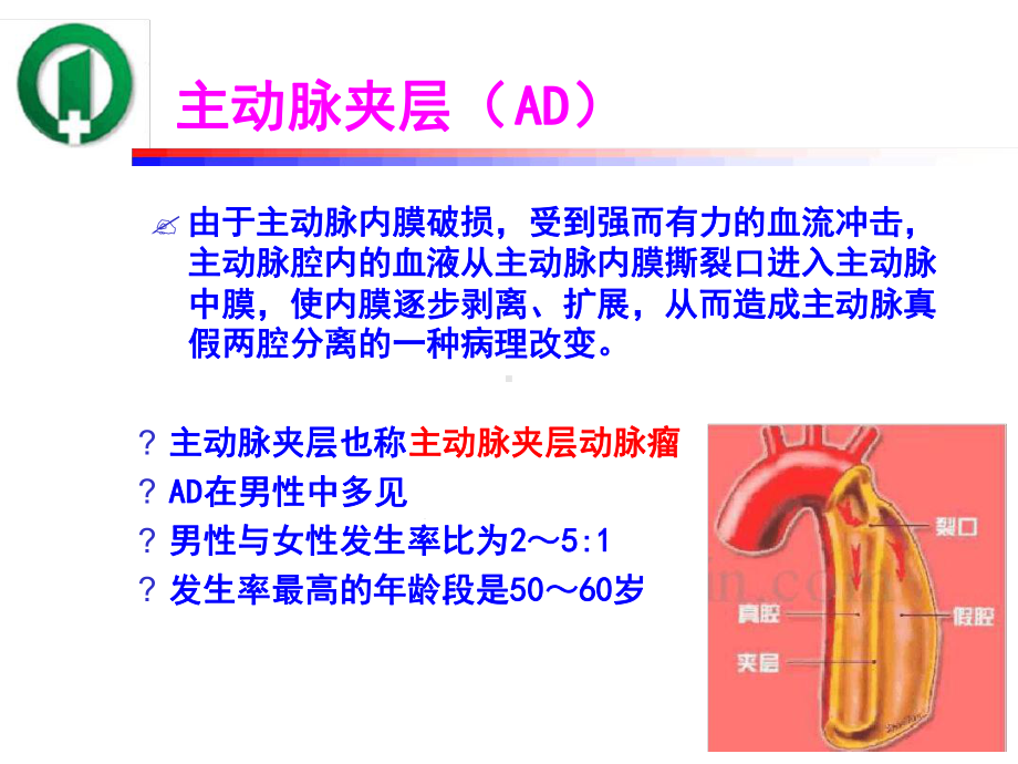 1例主动脉夹层术后患者并发肺不张的护理课件.ppt_第3页