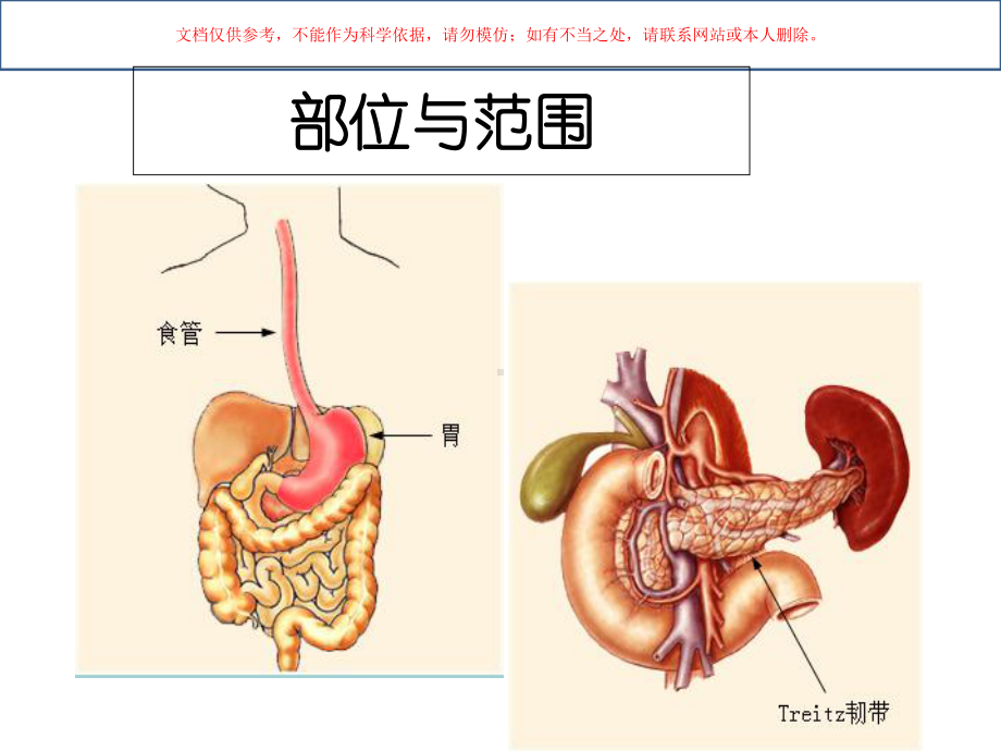 上消化道出血新版培训课件.ppt_第2页