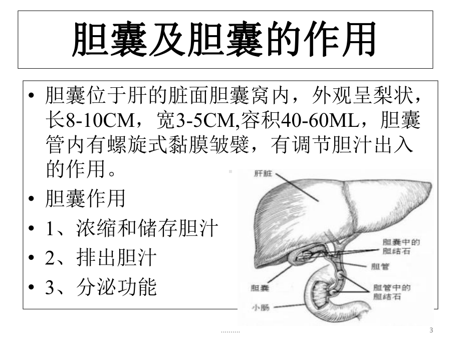 胆囊结石小讲课(可修改)课件.ppt_第3页