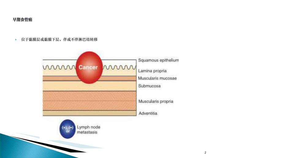 NBI放大在食管早癌诊断中的应用进展课件.ppt_第2页