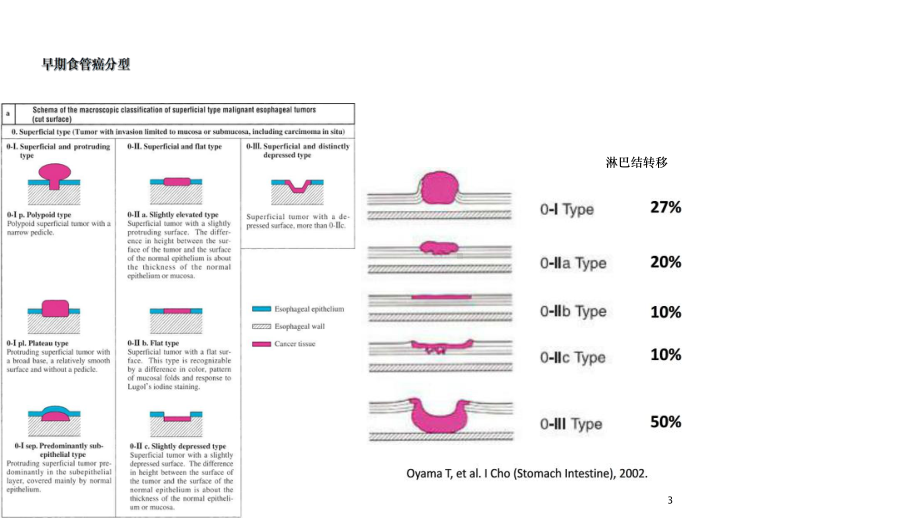 NBI放大在食管早癌诊断中的应用进展课件.ppt_第3页