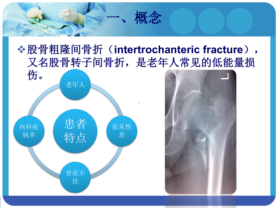 PFNA在股骨粗隆间骨折的应用课件.ppt_第3页