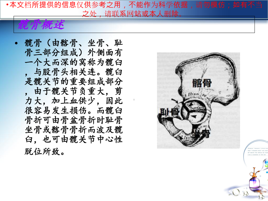 一例髋臼骨折医疗护理查房培训课件.ppt_第2页