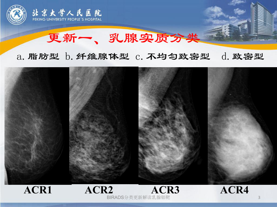 BIRADS分类更新解读乳腺钼靶讲义课件.ppt_第3页