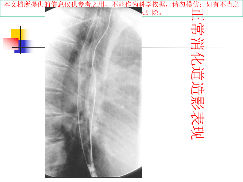 上消化道造影检查的适应症和禁忌症培训课件.ppt_第3页