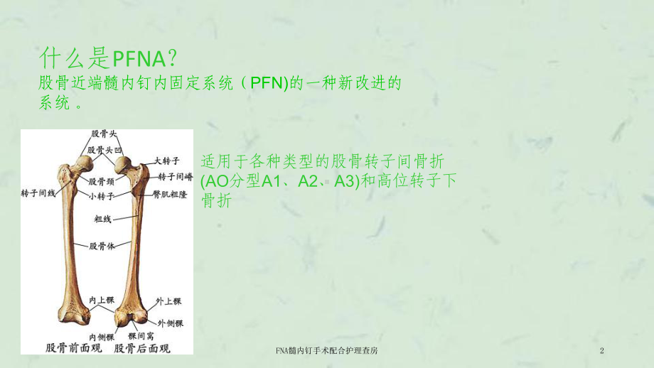 FNA髓内钉手术配合护理查房课件.ppt_第2页