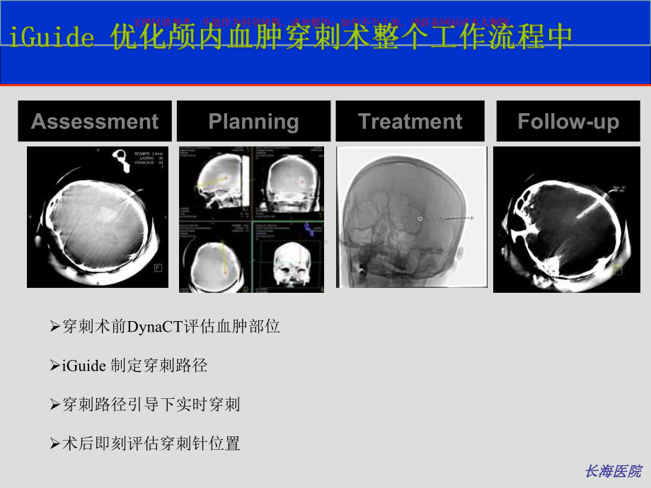 CT在神经介入中的运用体会培训课件.ppt_第3页