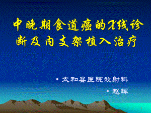 中晚期食道癌的X线诊断及内支架植入治疗课件.ppt