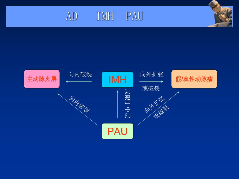 主动脉夹层壁间血肿及穿通性溃疡的影像诊断与鉴别诊断课件.pptx_第3页