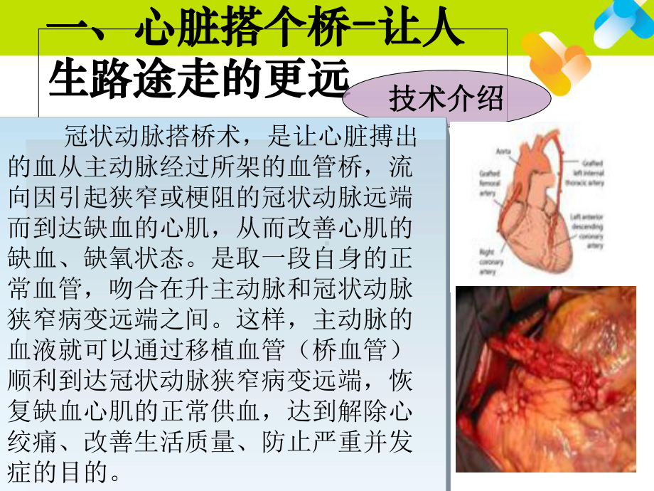 CT定位下经皮穿刺射频消融治疗晚期非小细胞肺癌-课件.ppt_第3页