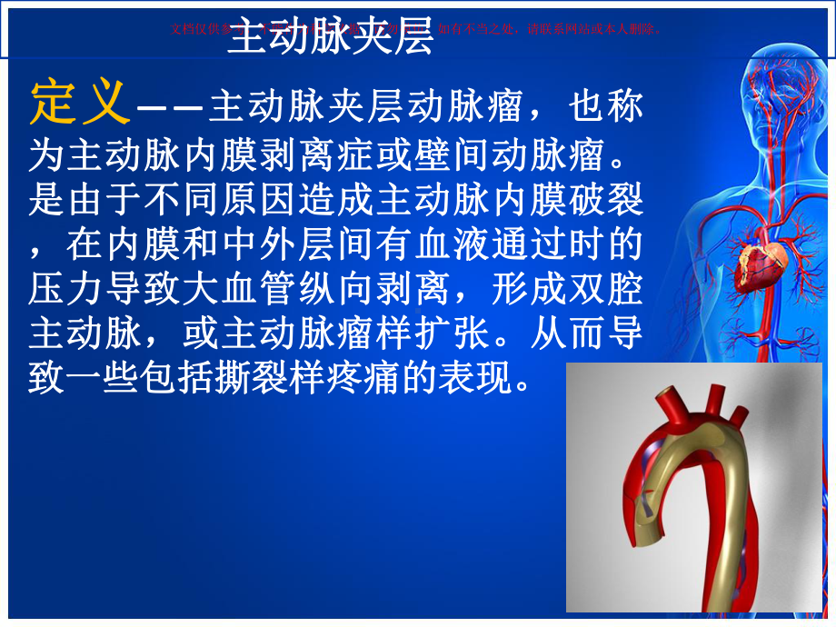 主动脉夹层护理查房培训课件.ppt_第1页