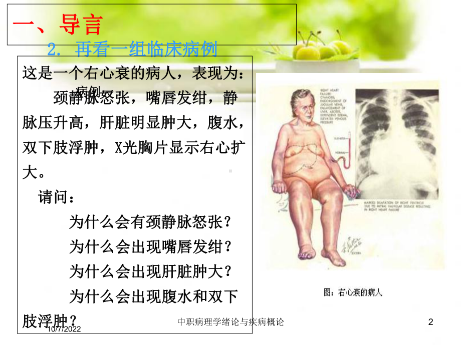 中职病理学绪论与疾病概论培训课件.ppt_第2页