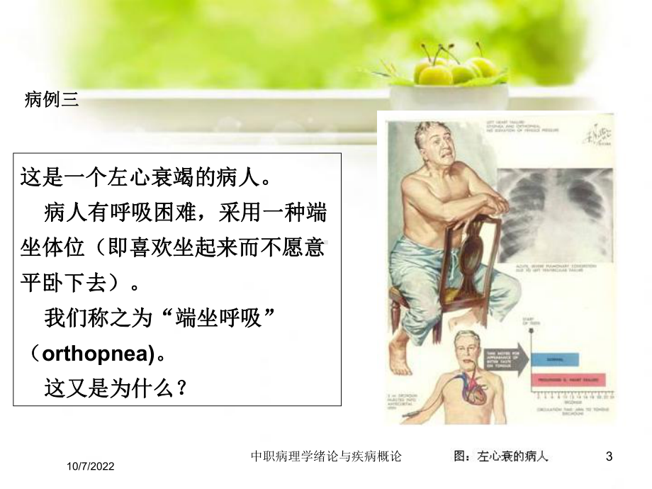 中职病理学绪论与疾病概论培训课件.ppt_第3页