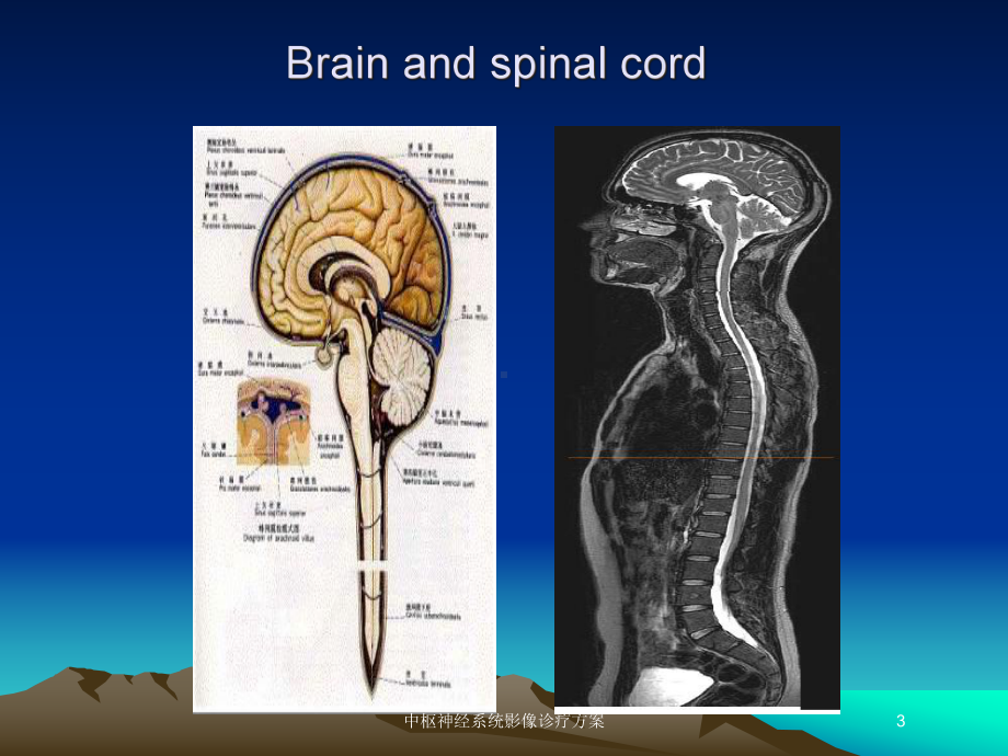 中枢神经系统影像诊疗方案培训课件.ppt_第3页