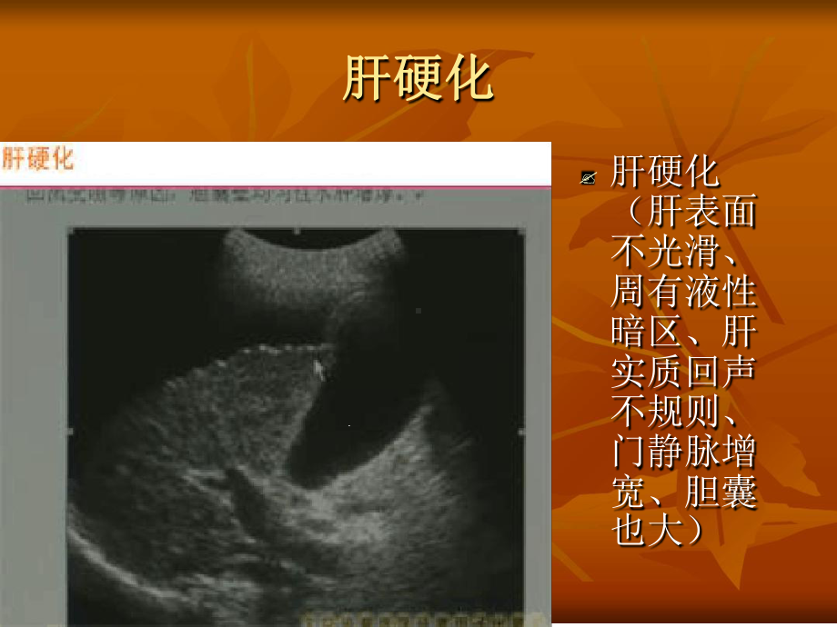 临床技能第三考站-B超-影像学课件.ppt_第3页