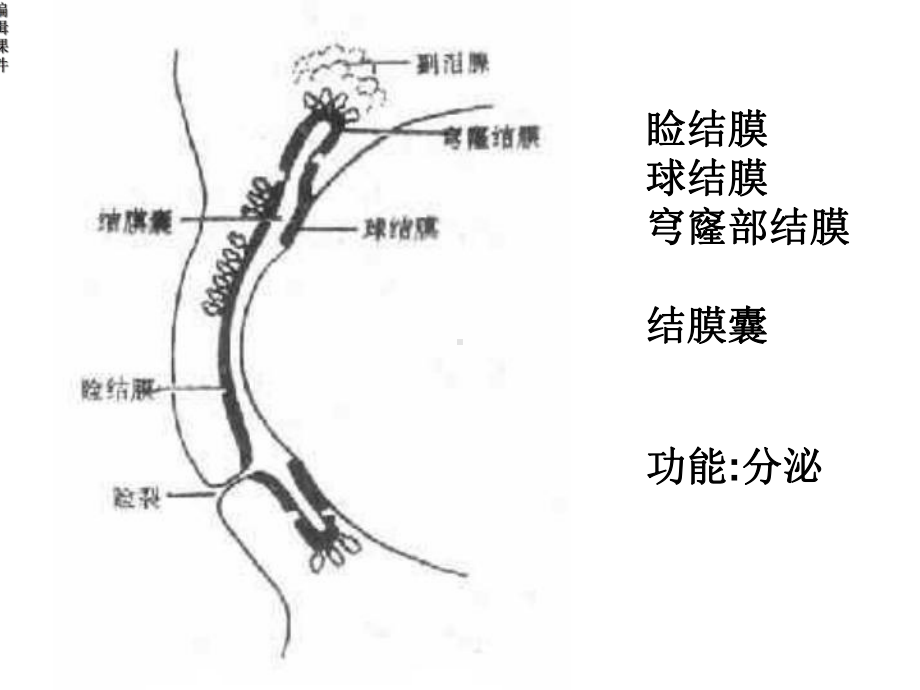 结膜炎病人的护理课件.ppt_第2页