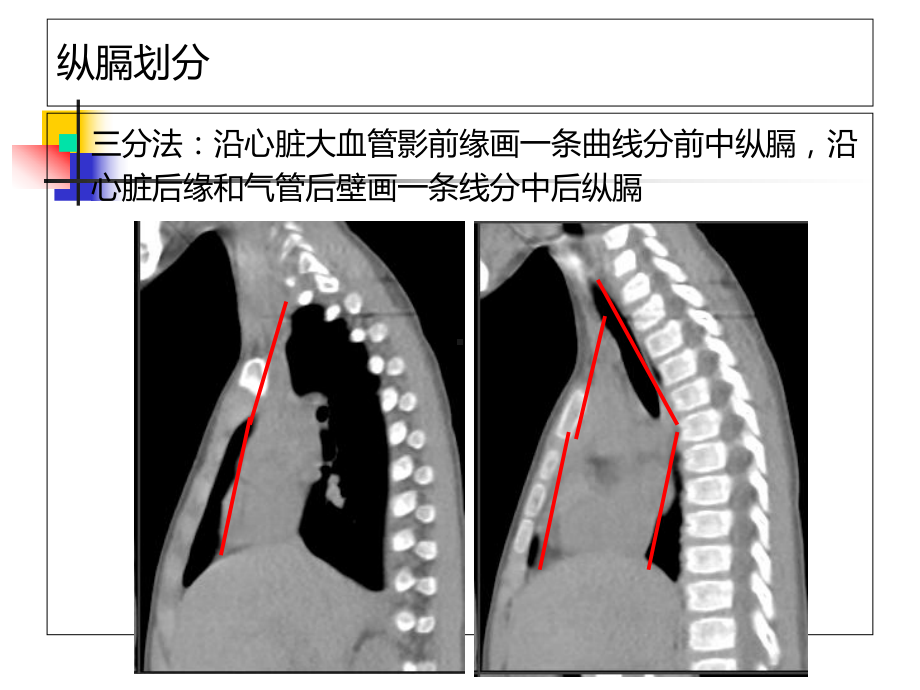 中后纵膈疾病诊断课件.ppt_第2页