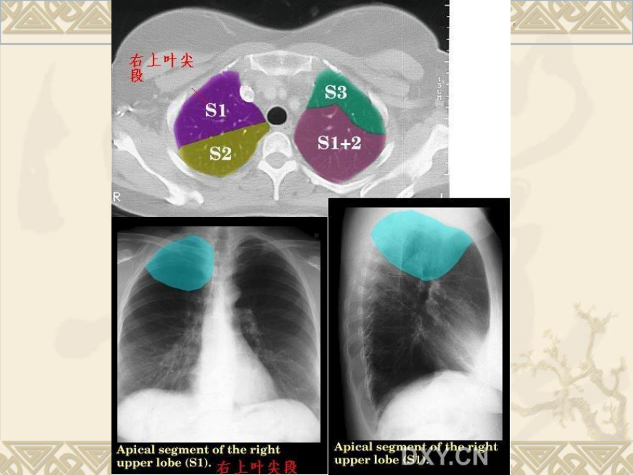 CT阅片肺段培训课件.ppt_第3页