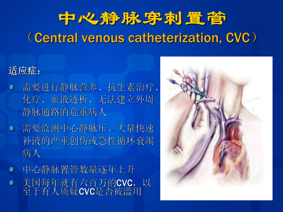 中心静脉导管的临床应用及意义医学课件.ppt_第2页