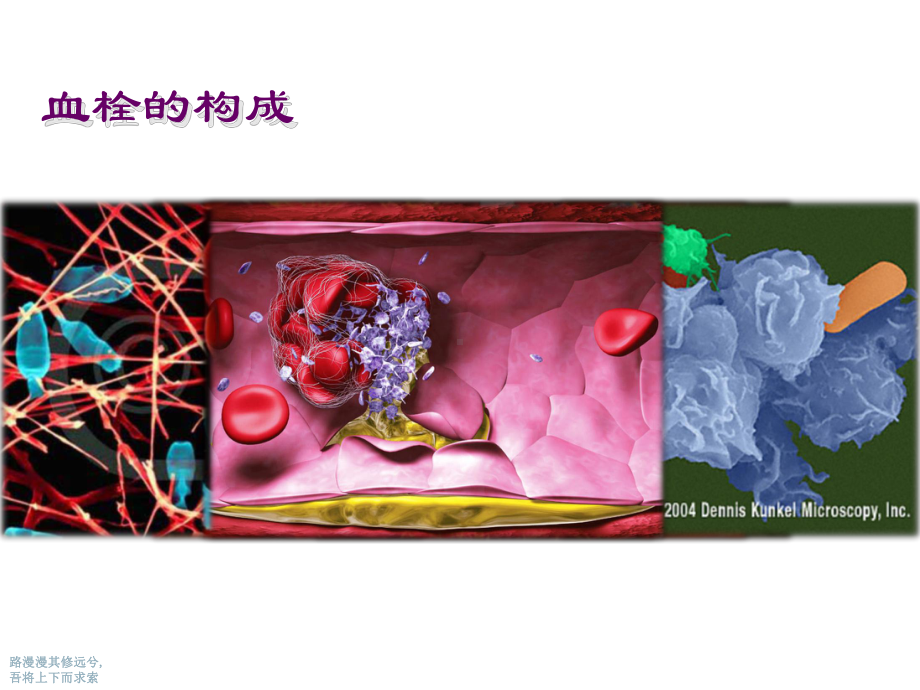 ACS抗栓治疗讲课课件.ppt_第2页