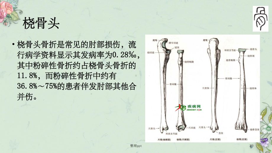 18年1月桡骨小头置换课件.ppt_第3页