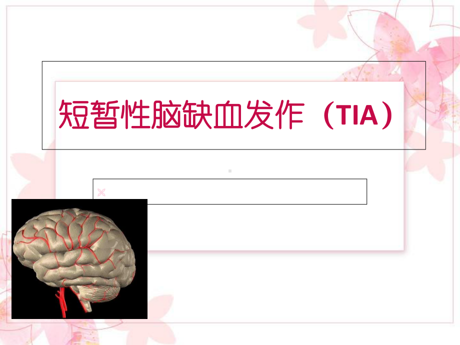 TIA的鉴别与诊断课件.ppt_第1页