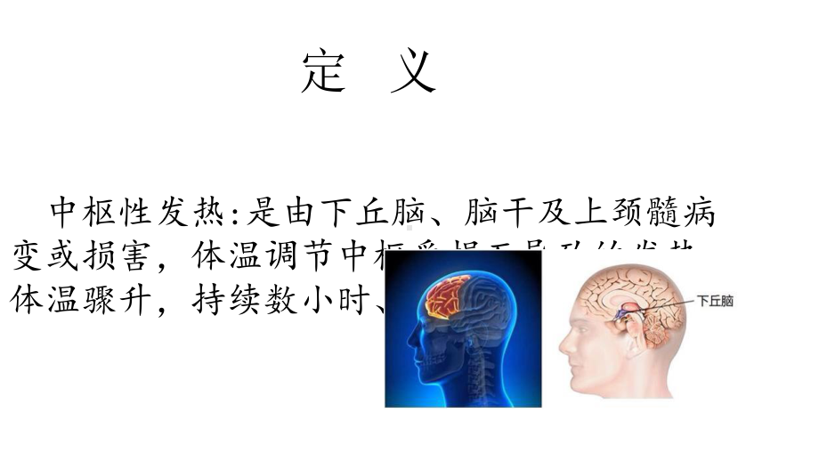 中枢性高热的医疗护理培训课件.ppt_第3页