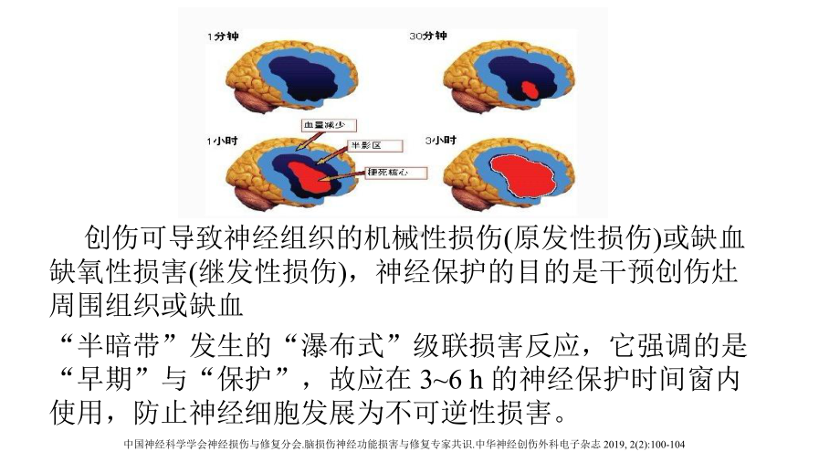 神经保护药物在创伤性脑损伤中的应用-课件.pptx_第2页