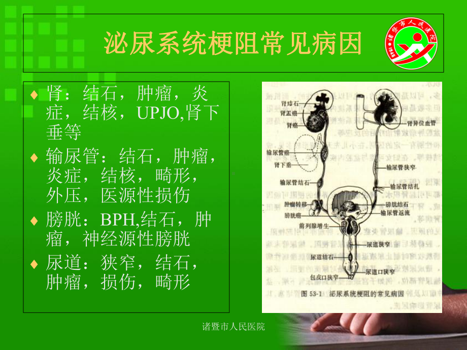 (外科学课件)泌尿系梗阻29.ppt_第2页