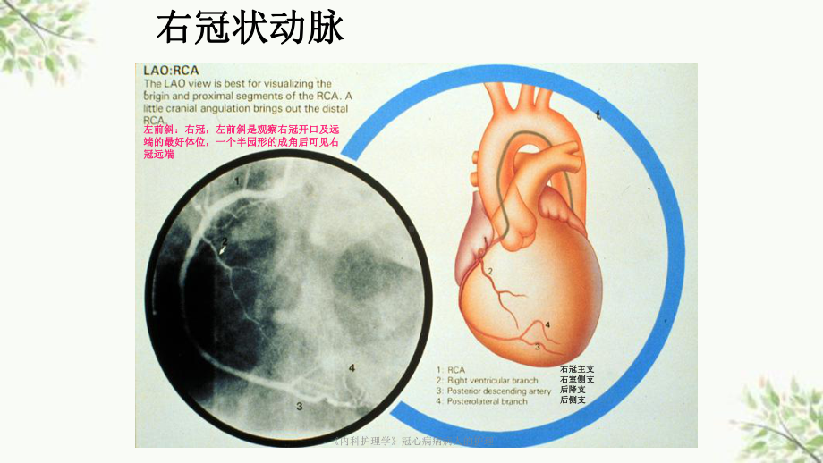 《内科护理学》冠心病病病人的护理课件.ppt_第3页