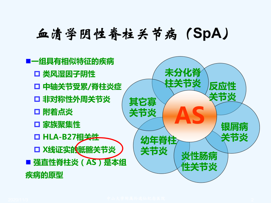 SpA骶髂关节炎影像学诊断和鉴别诊断课件.ppt_第2页