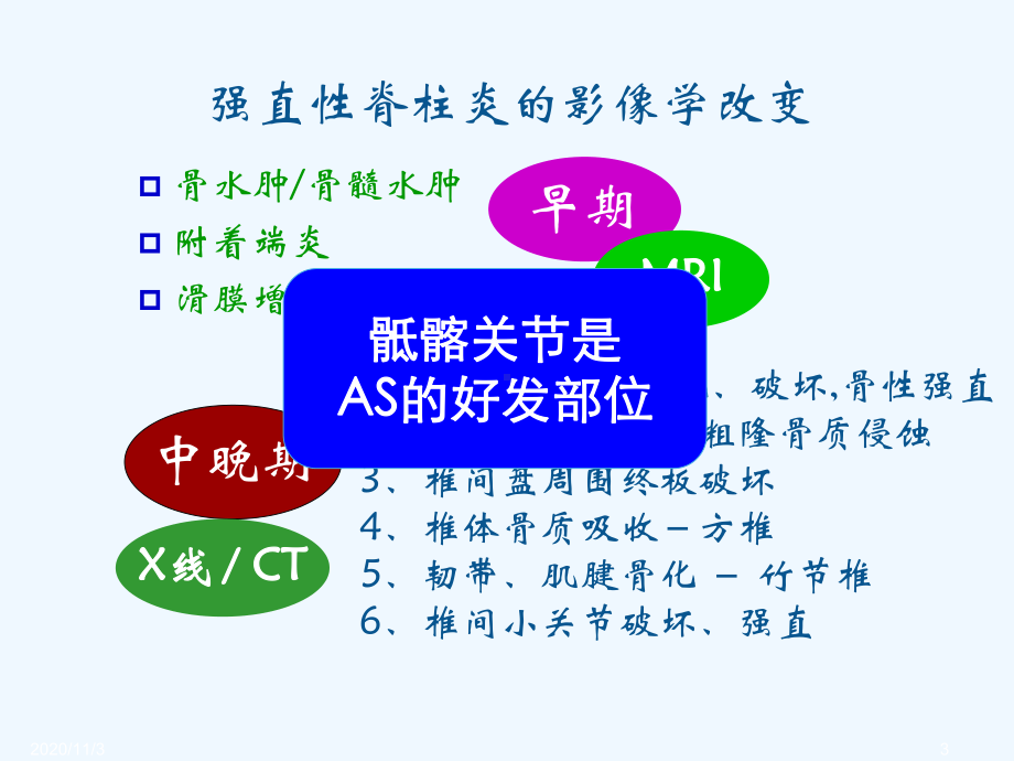 SpA骶髂关节炎影像学诊断和鉴别诊断课件.ppt_第3页