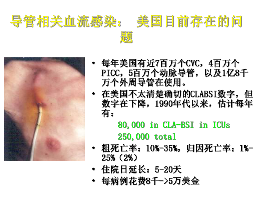 美国导管相关血流感染预防与控制技术指南的解析课件.ppt_第2页